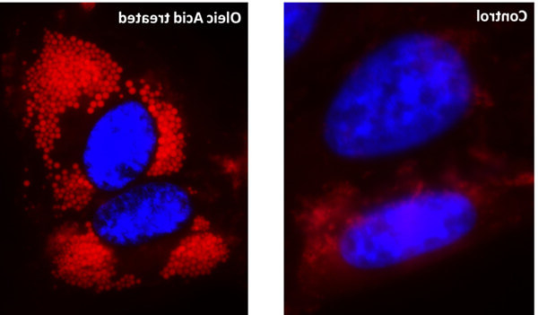 油酸处理的 HeLa 细胞（右）脂滴染色.jpg